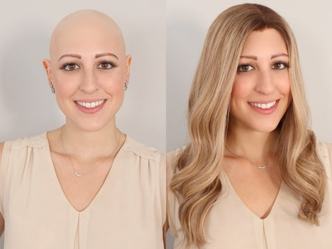 Wigs for Women with Alopecia